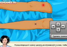 Игры Дора Операция после перелома ноги