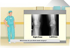 Игры больницы Операция на колене