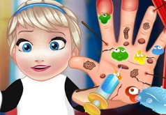 Игра Малышка Эльза: операция на руке